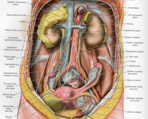 URETERÓLISE LAPAROSCÓPICA UNI OU BILATERAL